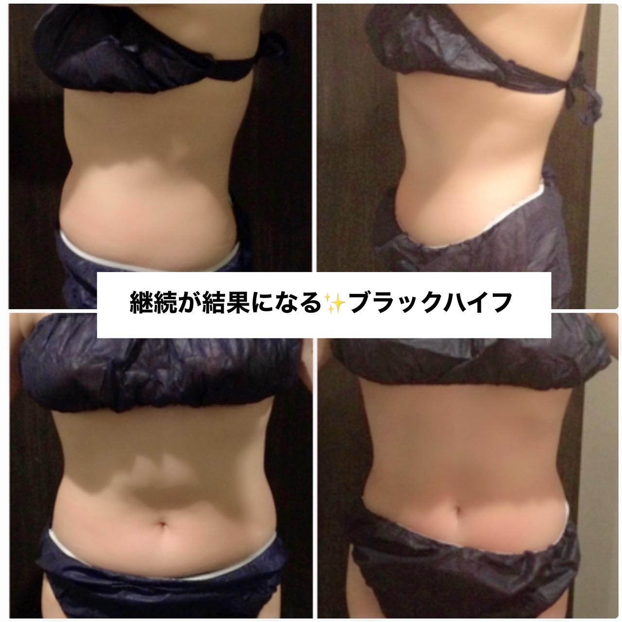 ☆ブラックハイフ10回目のお客様☆