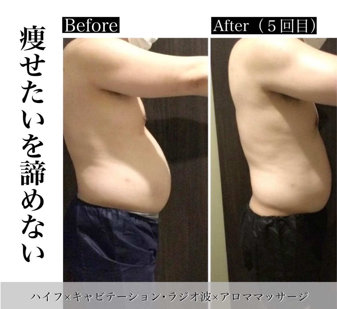 痩せたいを諦めていませんか？【ブラックハイフ】